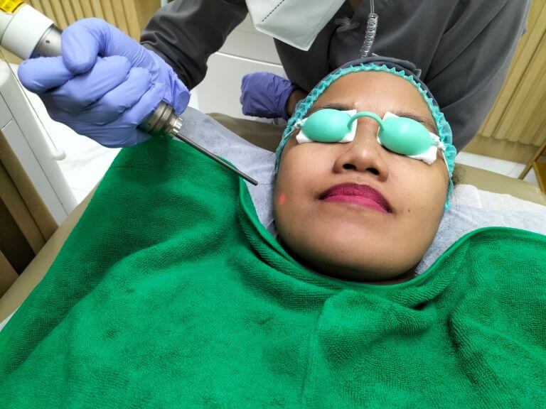 Laser toning